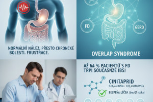 Kámen v žaludku a „normální“ nález? Studujte nové kazuistiky zdarma na euni.cz